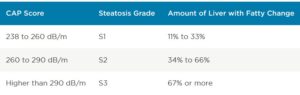 Fibroscan™ (Sound Based Elastography) | Gastro Health - Framingham